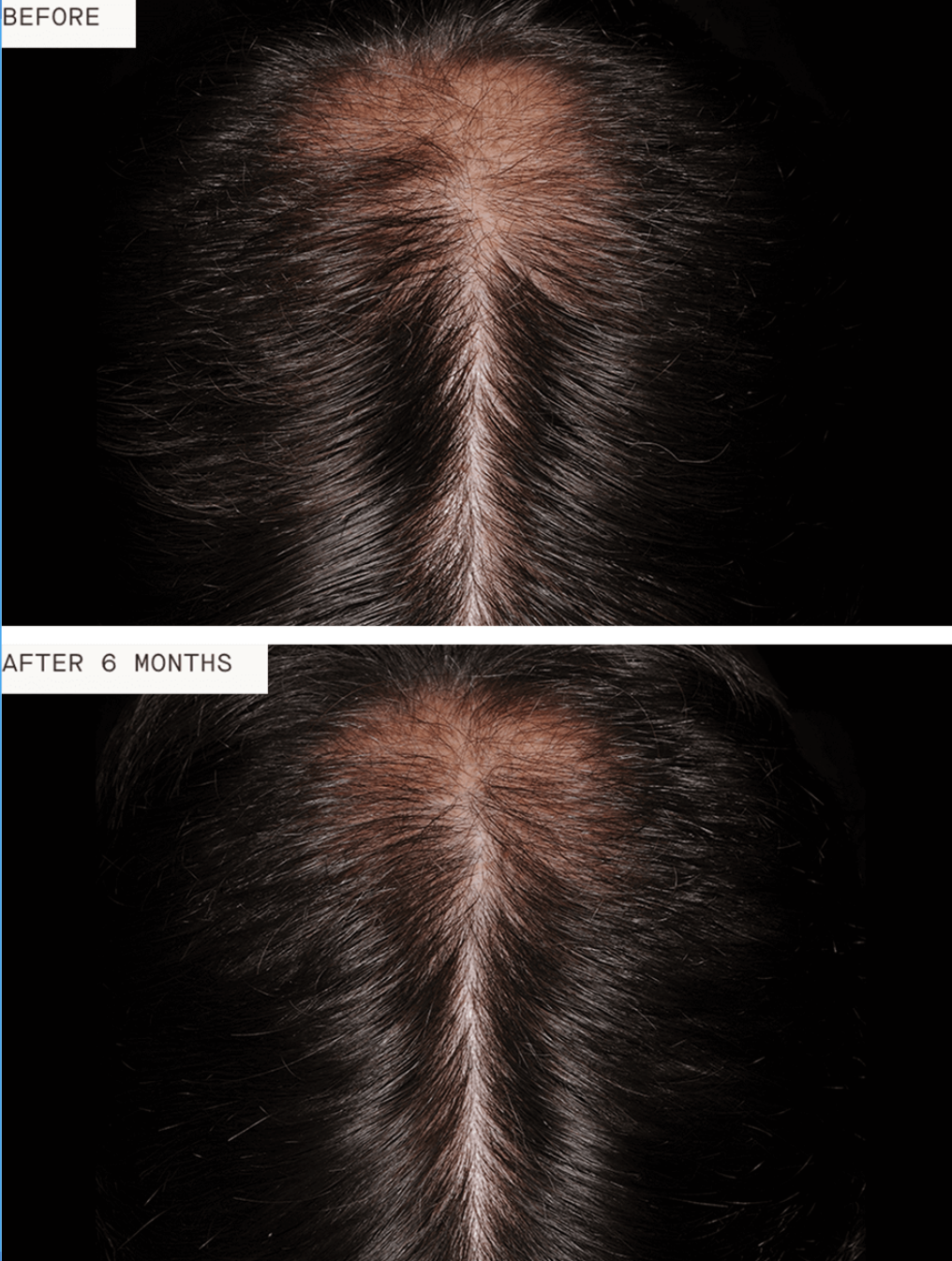 Nutrafol Men - 3 month supply